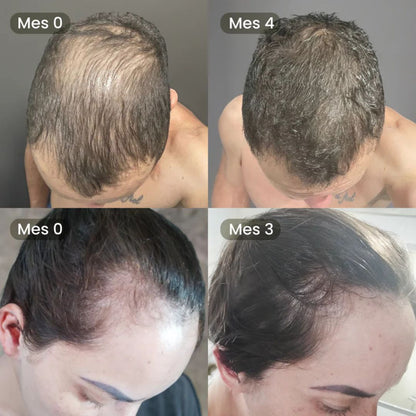 Aceite de Batana Premium 2 en 1 – Tratamiento Capilar Reparación y Crecimiento Capilar